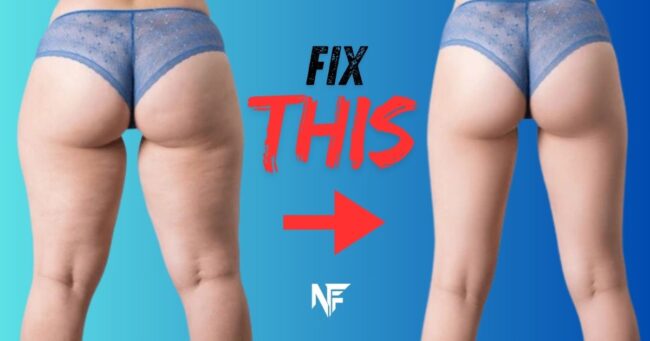 How Get Tid of Cellulite on Butt Fastly?